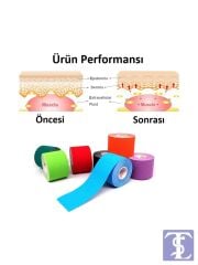 Acura AC-150 Yüz & Vücut Uyumlu Hipoalerjenik Kinezyo Bant 5m x 5cm