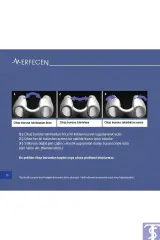 ERFECEN BURUN DELİĞİ ŞEKİLLENDİRİCİ / NOSTRIL RETAINER