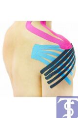 Kifidis Kinesio Bandı 5cm x 5m (Siyah-Bej-Fuşya-Mavi)